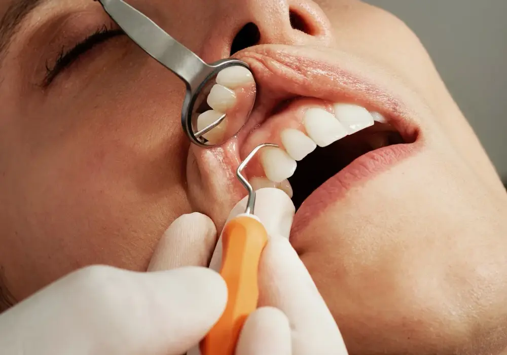 Czy można iść do dentysty w ciąży? Bezpieczne zabiegi i porady