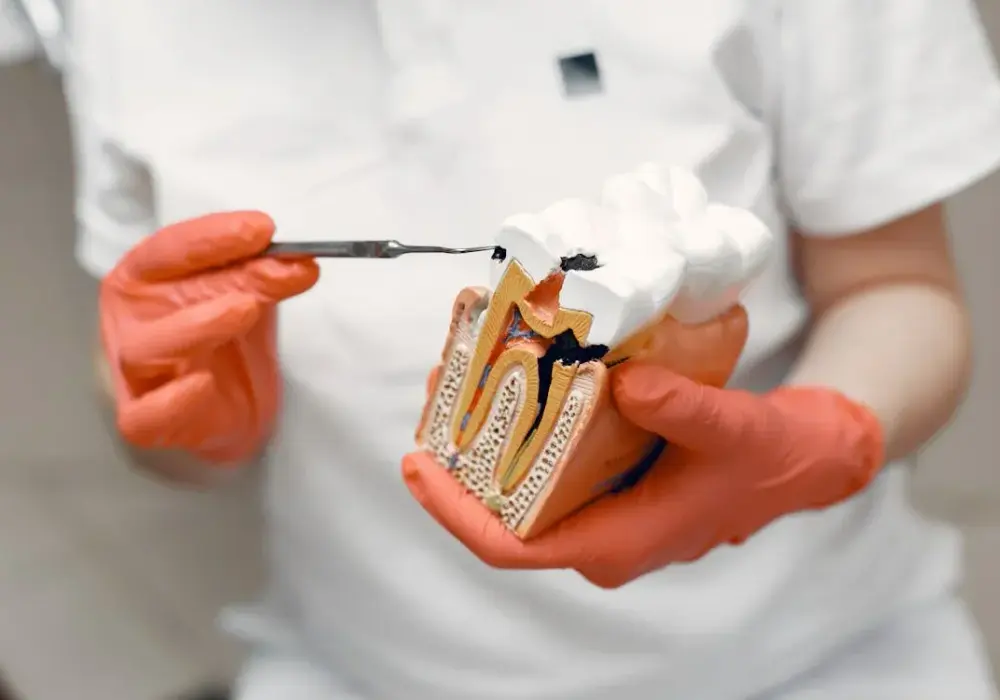 Jak wyleczyć próchnicę bez dentysty? Skuteczne metody w domu