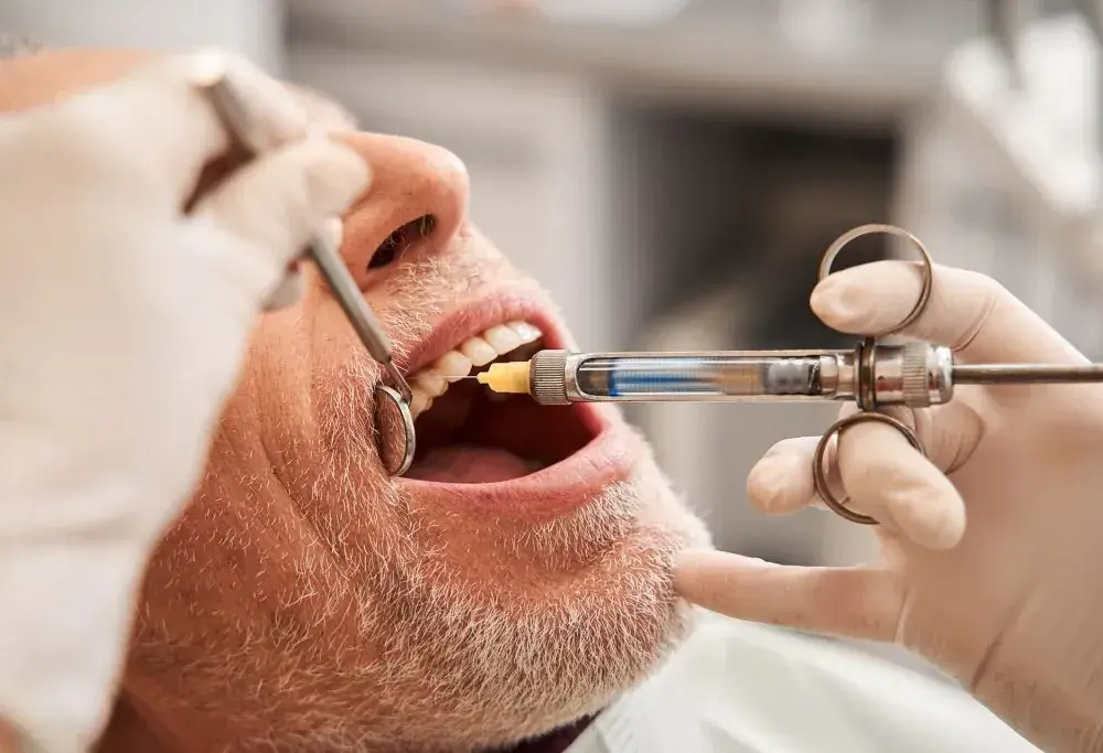 Ile kosztuje znieczulenie u dentysty na nfz? Wszystko, co musisz wiedzieć