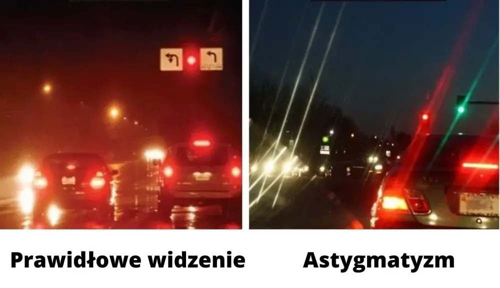 Astygmatyzm co to za wada? Objawy, przyczyny i skuteczne leczenie
