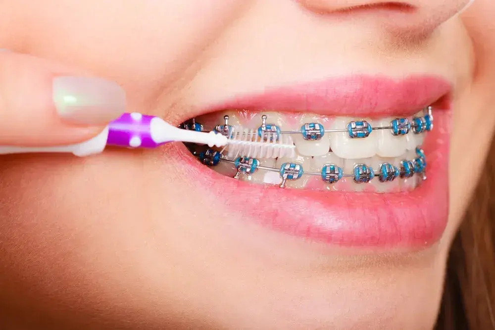 Czym się różni dentysta od ortodonty? Kluczowe informacje, które musisz znać