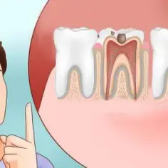 Co robi dentysta gdy boli ząb? Poznaj skuteczne metody leczenia bólu