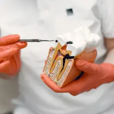 Jak wyleczyć próchnicę bez dentysty? Skuteczne metody w domu