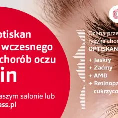 Jak wygląda badanie wzroku w Vision Express - co musisz wiedzieć?