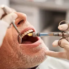 Ile kosztuje znieczulenie u dentysty na nfz? Wszystko, co musisz wiedzieć