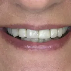 Czy podczas okresu można iść do dentysty bez obaw o ból?