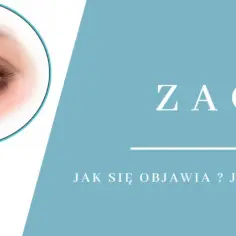 Dlaczego powstaje zaćma? Poznaj przyczyny i jak ich unikać