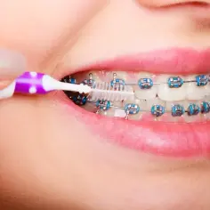 Czym się różni dentysta od ortodonty? Kluczowe informacje, które musisz znać
