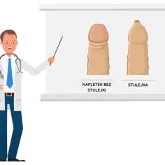 Stulejka: Urolog czy chirurg - Kto najlepiej leczy ten problem?