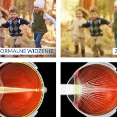 Jak rozpoznać objawy zaćmy i uniknąć utraty wzroku
