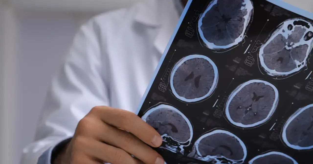 Zdjęcie Neurologia czym się zajmuje? Poznaj kluczowe aspekty tej dziedziny