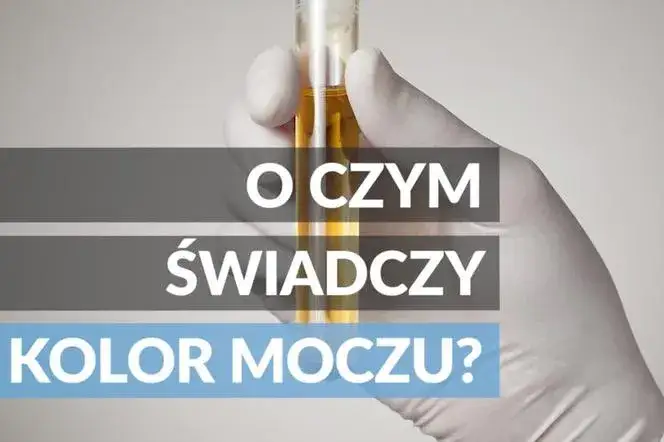 Zdjęcie Jakie badanie moczu do urologa? Dowiedz się, co może wykryć